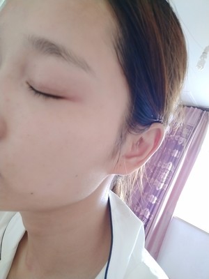 薇諾娜舒敏保濕面膜怎么樣？可以每天使用嗎