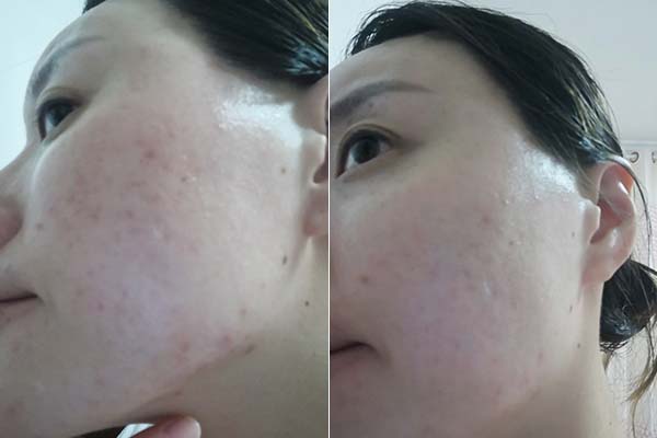 悅木之源菌菇水怎么樣？適合什么類型肌膚？
