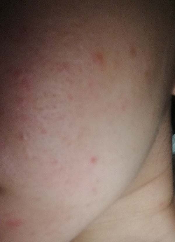 薇諾娜舒敏保濕修紅霜適合什么膚質，薇諾娜舒敏保濕修紅霜使用評測