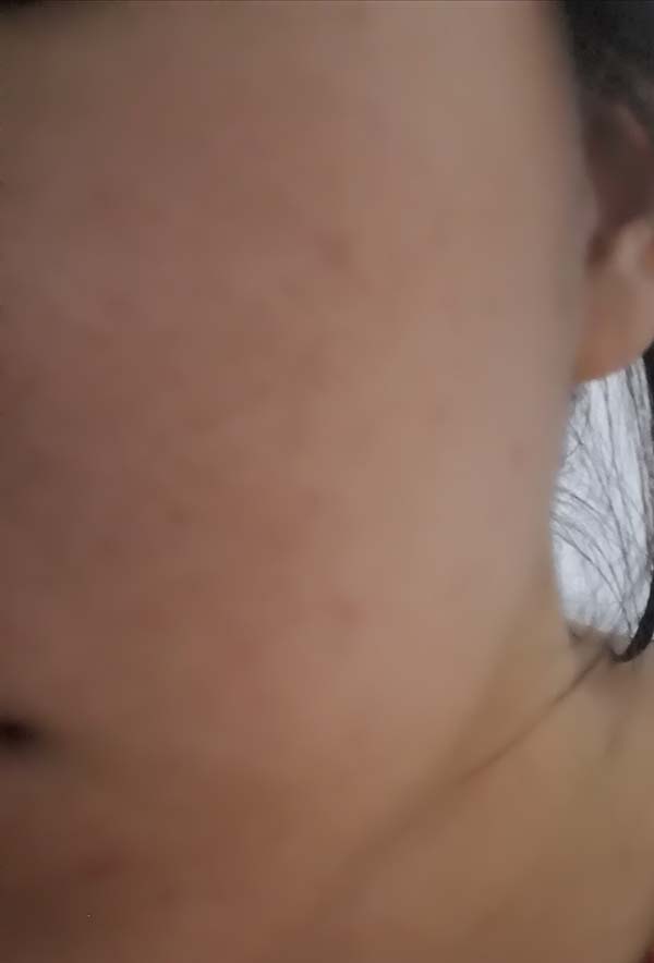 薇諾娜舒敏保濕修紅霜適合什么膚質，薇諾娜舒敏保濕修紅霜使用評測