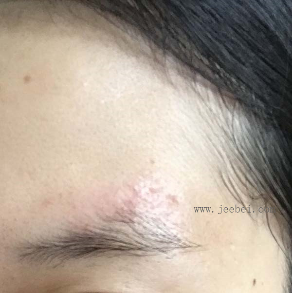 薇諾娜舒敏保濕精華液
