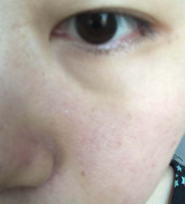 薇諾娜舒敏保濕絲滑面膜怎么樣 薇諾娜舒敏保濕絲滑面膜使用測評