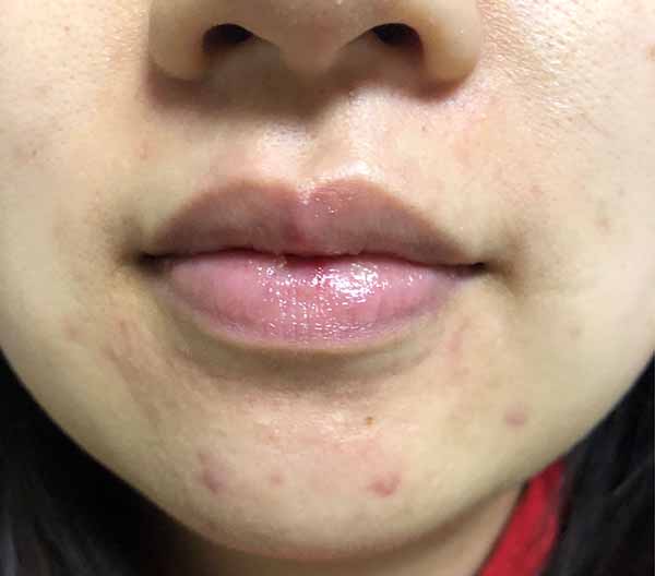 理膚泉k乳怎么樣 理膚泉k乳使用測評