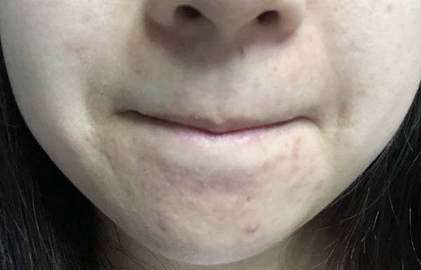 理膚泉k乳怎么樣 理膚泉k乳使用測評