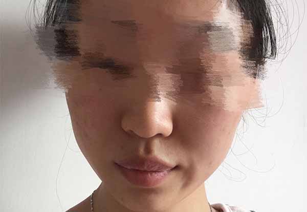 花印抗痘補濕凝露怎么樣 效果好嗎