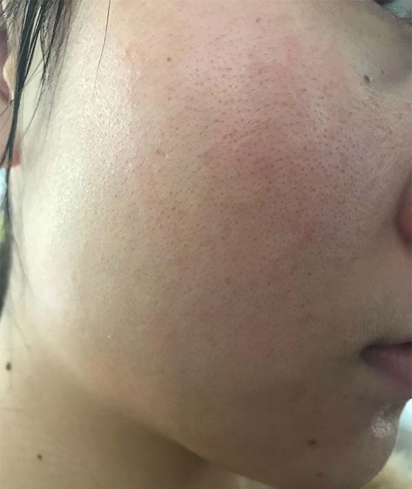 蘇芊玫瑰果油面霜怎么樣，蘇芊面霜孕婦可以用嗎